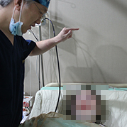 術后醒麻醉恢復