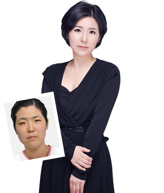 韓國(guó)灰姑娘整形外科真實(shí)整形日記